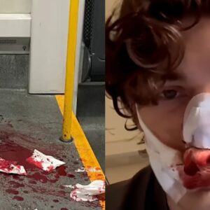 A young American stops the sexual assault of a German woman by two Syrians on a tram and ends up stabbed