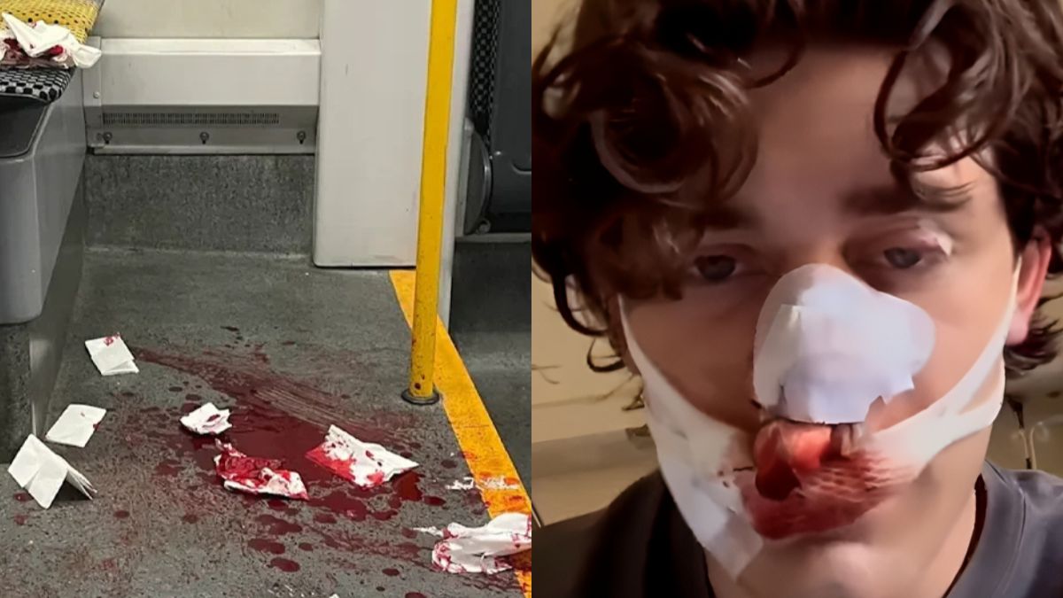 A young American stops the sexual assault of a German woman by two Syrians on a tram and ends up stabbed